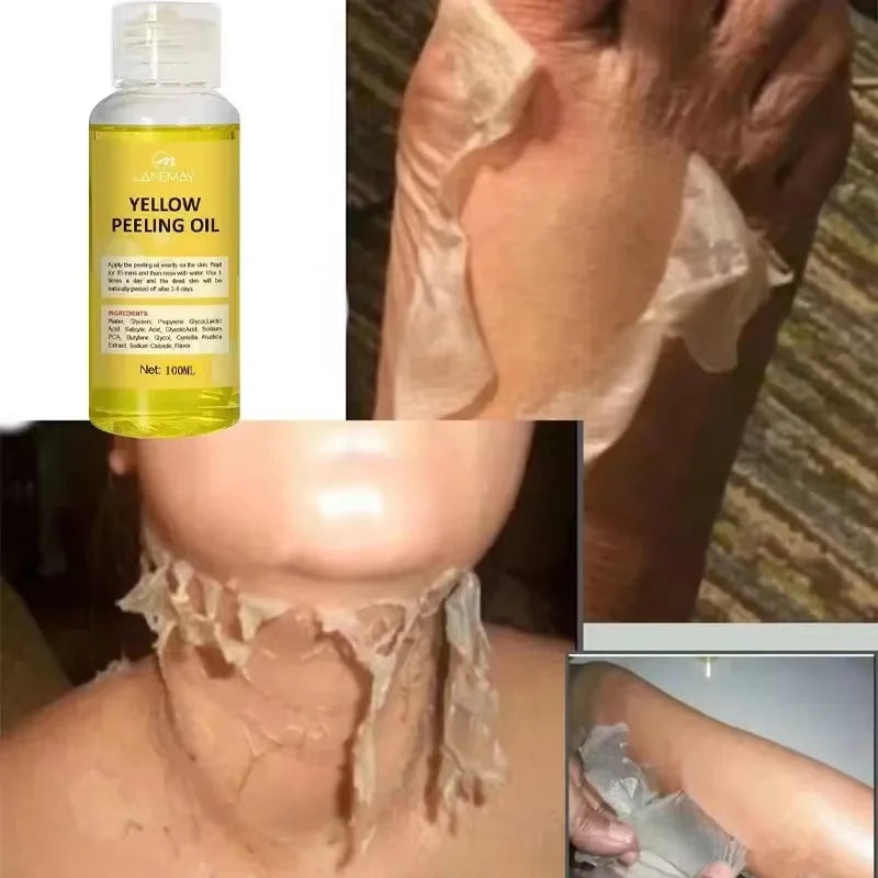 Yellow Peeling Oil Exfoliating Dead Skin Serum Care Dark Skin Bleaching Remove Knee Arm Legs Melanin Body Brighten Scrub Whiten