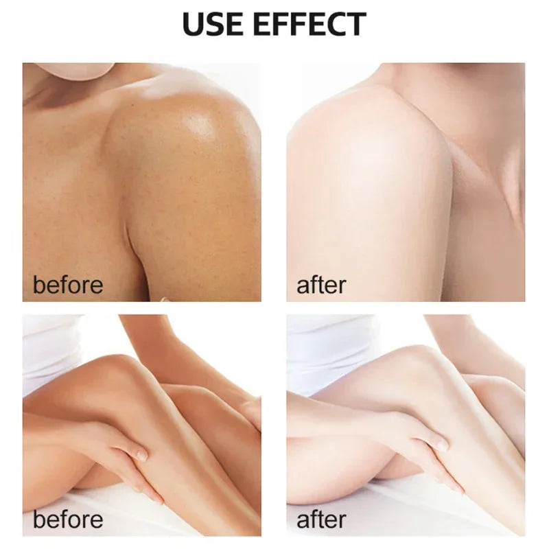 Yellow Peeling Oil Exfoliating Dead Skin Serum Care Dark Skin Bleaching Remove Knee Arm Legs Melanin Body Brighten Scrub Whiten