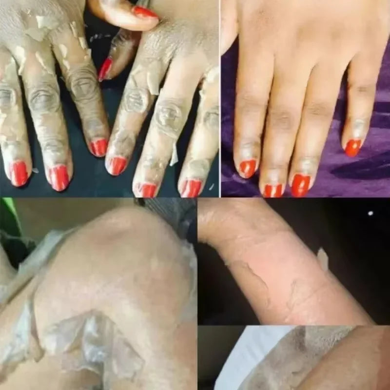 Yellow Peeling Oil Exfoliating Dead Skin Serum Care Dark Skin Bleaching Remove Knee Arm Legs Melanin Body Brighten Scrub Whiten